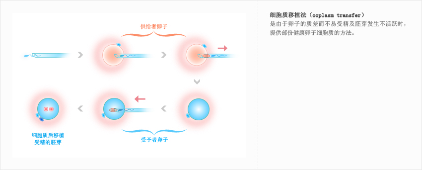 细胞质移植法（ooplasm transfer）:是由于卵子的质差而不易受精及胚芽发生不活跃时，提供部份健康卵子细胞质的方法。