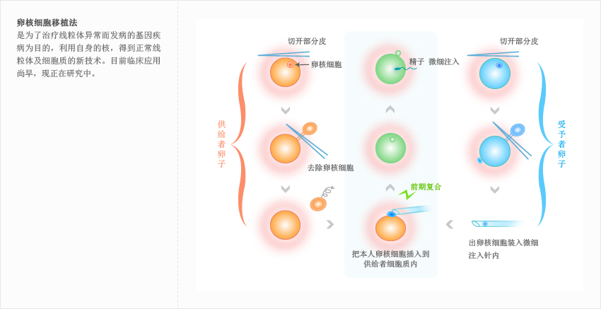 卵核细胞移植法 : 是为了治疗线粒体异常而发病的基因疾病为目的，利用自身的核，得到正常线粒体及细胞质的新技术。目前临床应用尚早，现正在研究中。