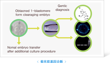 着床前基因诊断