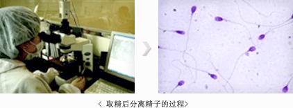 채취된 정자를 분리하는 과정 사진